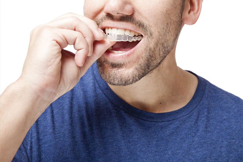 Orthodontics - Downey Beautiful Smile, Downey Dentist